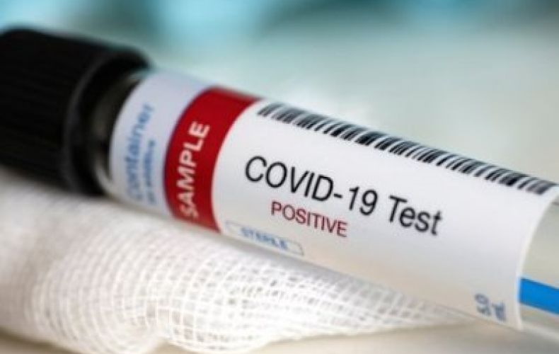 Armenia confirms 239 new cases of coronavirus in one day