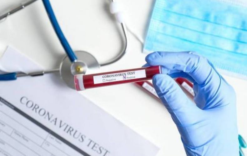 289 people in Armenia are infected with COVID-19 in one day