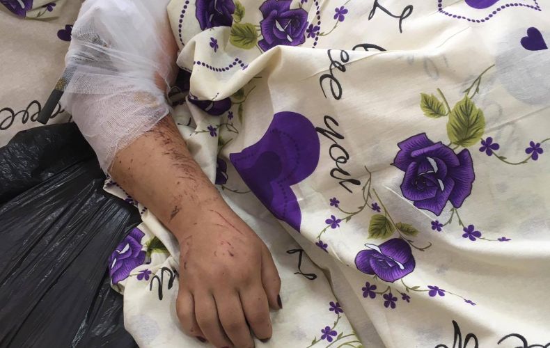Արտակ Բեգլարյանը այցելել է ադրբեջանական ագրեսիայի հետևանքով վիրավորված քաղաքացիական անձանց