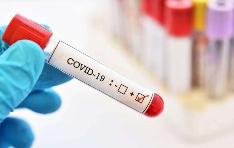 Արցախում գրանցվել է կորոնավիրուսային հիվանդության 10 նոր դեպք