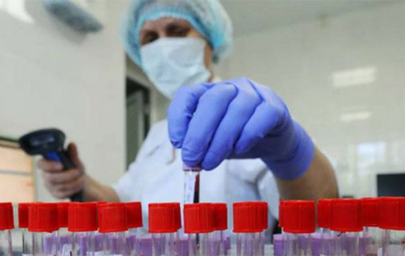 10 new cases of coronavirus confirmed in Artsakh