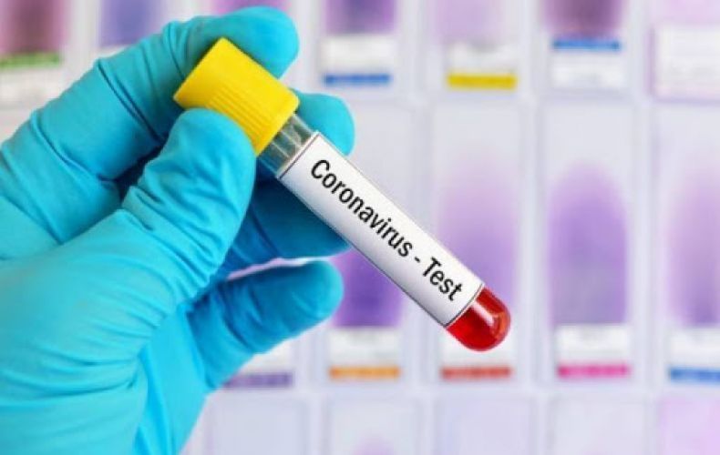В Арцахе выявлено 4 случая заболевания коронавирусом
