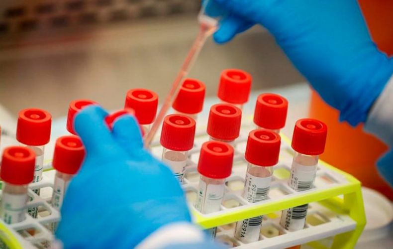 В Арцахе выявлено 5 новых случаев заболевания коронавирусом: Общее количество зарегистрированных случаев - 2971
