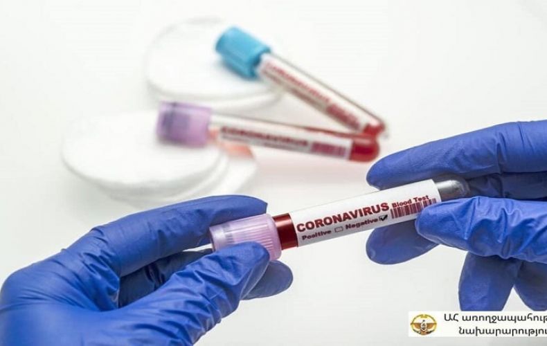 В Арцахе зарегистрировано 10 новых случаев заболевания коронавирусом