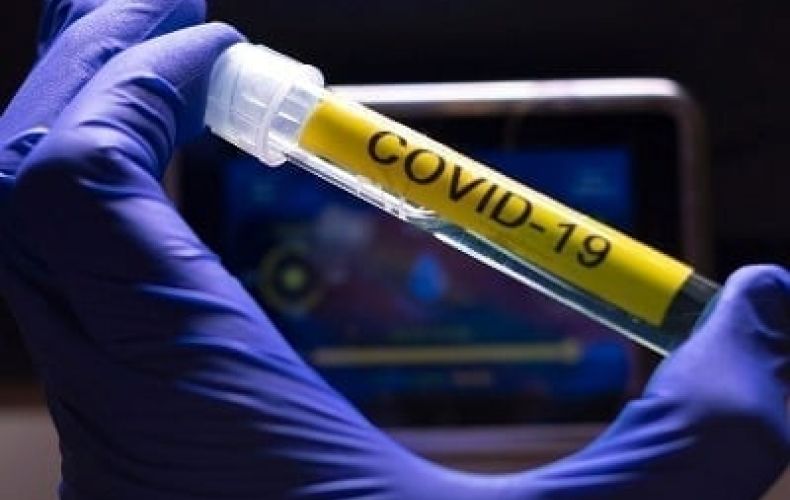 63 new coronavirus cases confirmed in Artsakh