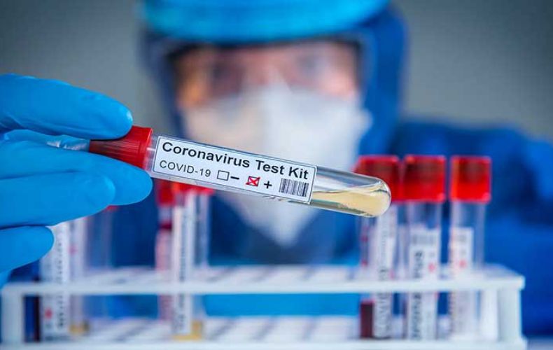 38 new coronavirus cases confirmed in Artsakh