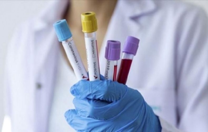 В Арцахе подтверждено 62 новых случая коронавирусной инфекции