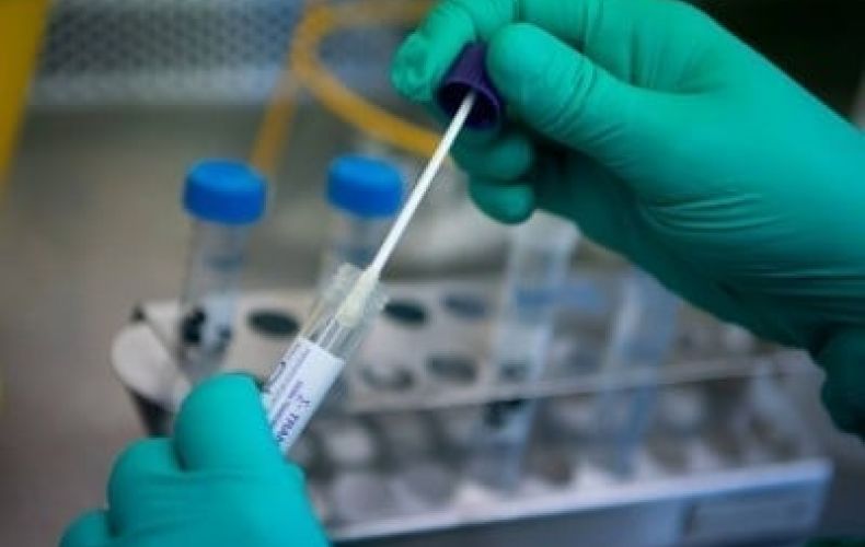 В Арцахе выявлено 45 новых случаев заражения коронавирусом