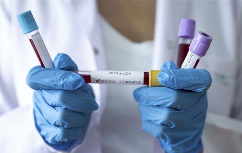 В Арцахе подтверждено 12 новых случаев коронавирусной инфекции