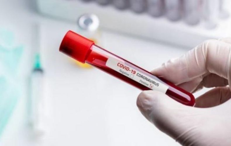 В Арцахе выявлено 10 новых случаев заболевания коронавирусом