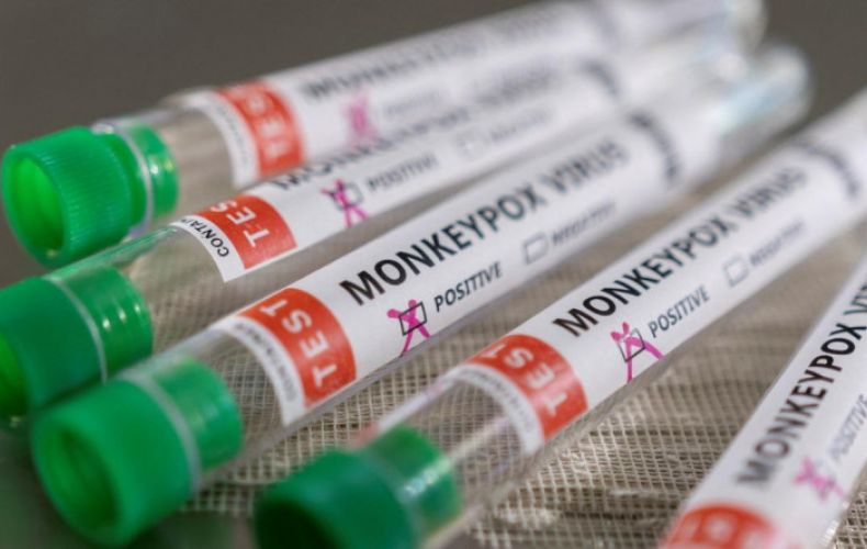 Monkeypox virus outbreaks are containable, WHO says