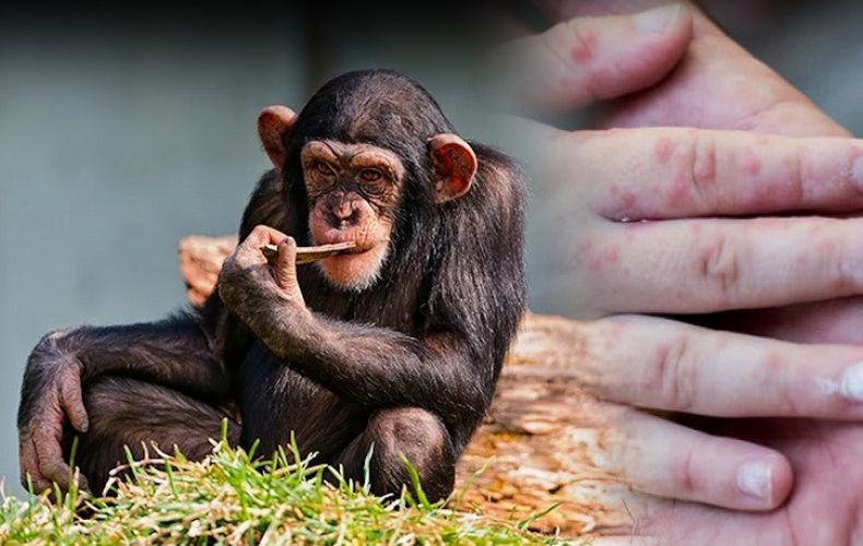 Armenia bans imports of primates, rodents to prevent spread of monkeypox